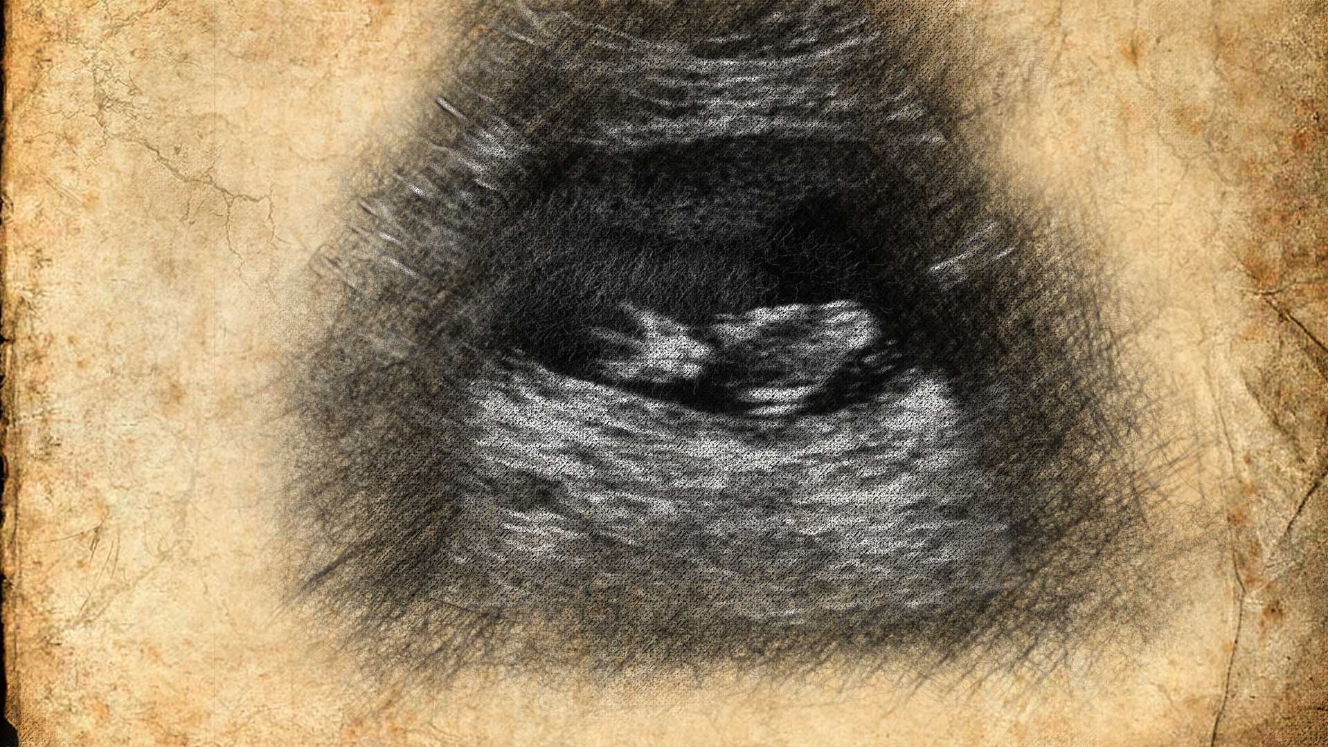 Ultrasound Sketch